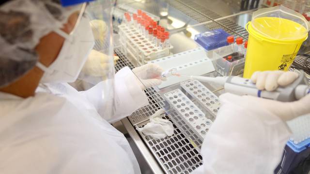 Karlovački epidemiolozi dnevno obrade preko 200 testova na koronavirus