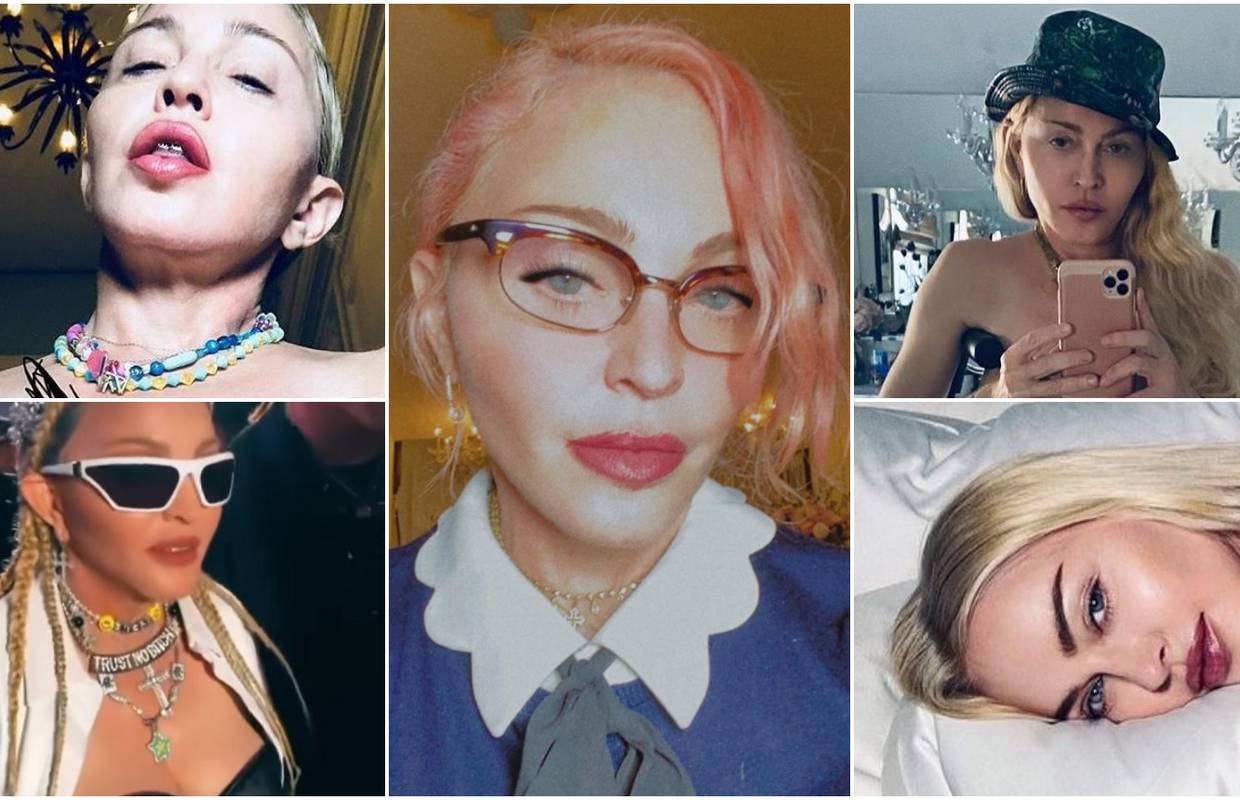 Kirurg je izračunao: Madonna je na plastične operacije potrošila minimalno 1,4 milijuna kuna