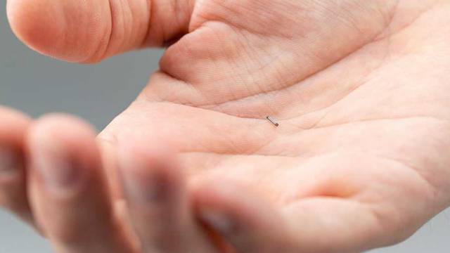 Implantat veličine sjemenke novost u operaciji raka dojke