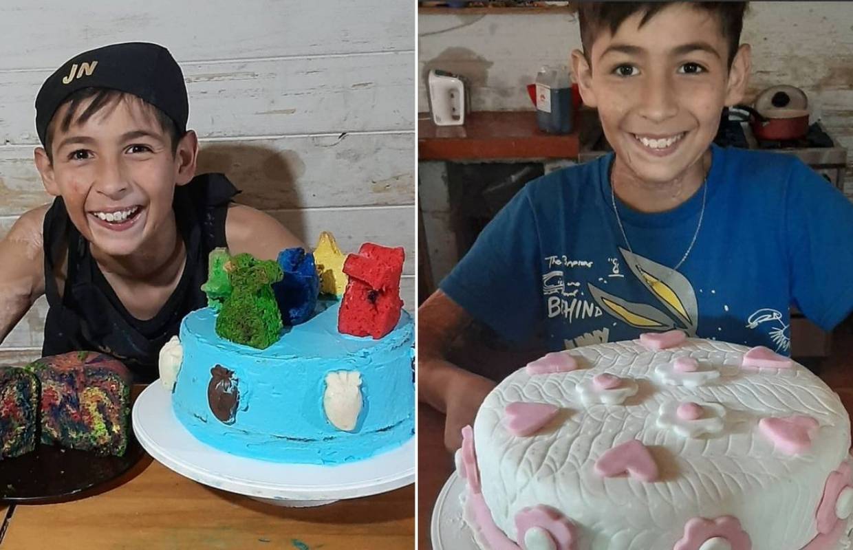 Desetogodišnji Joaquin prodaje kolače kako bi zaradio novac za rekonstrukciju opečene kože lica