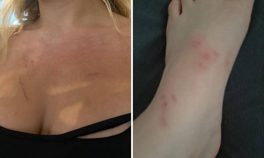 VIDEO Vlasnica (60) restorana napala dvije konobarice: 'Bacila me na ormar i uzela mi novac...'