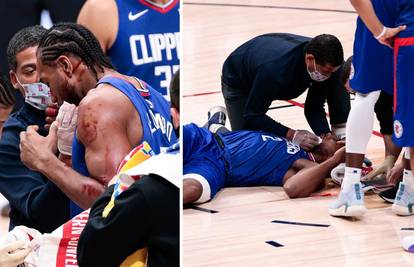 Užas u NBA-u: Zubac gledao u šoku krvavog Kawhija na podu