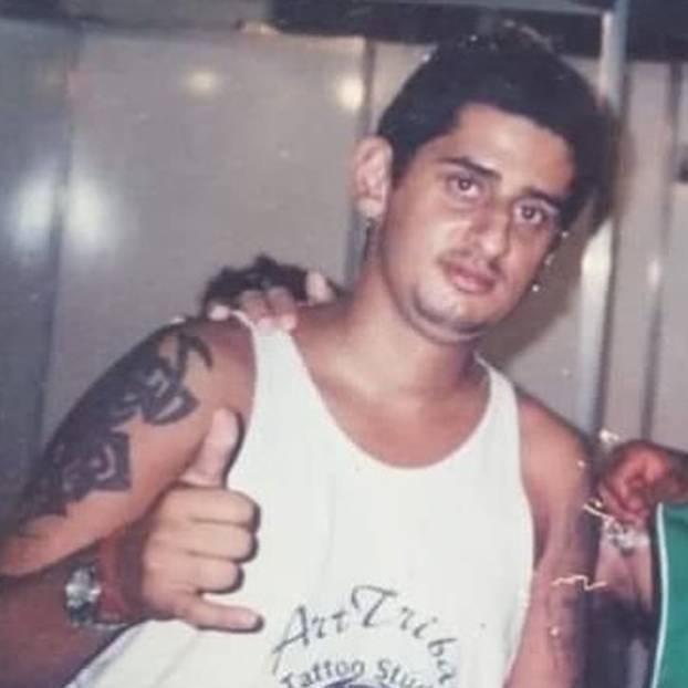 FOTO Uznemirujuće! Uklonila je čak i vrh nosa, a evo kako je izgledala: Šteta, ljepotica si bila