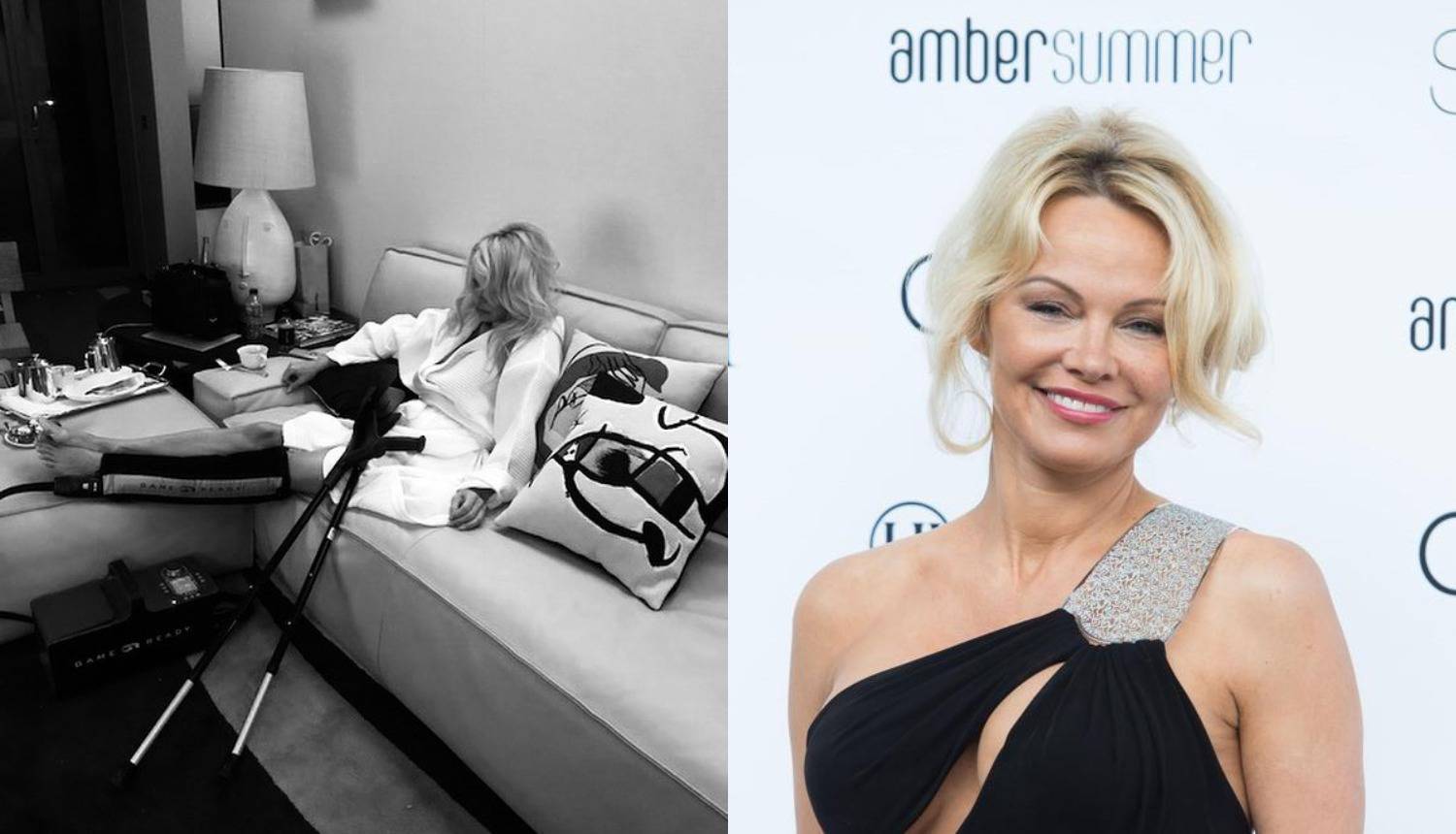 Nespretna Pamela Anderson: Ozlijedila je nogu dok je plesala