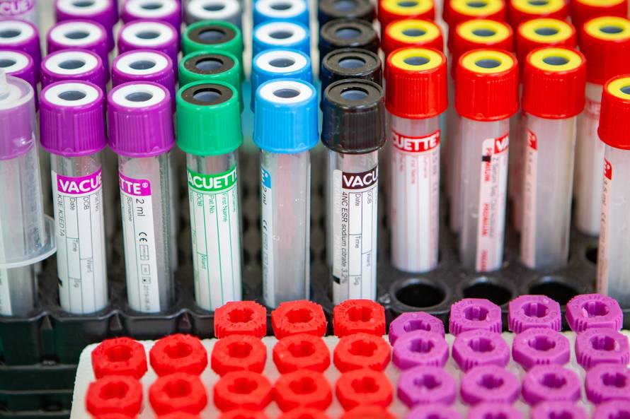 Medicinski pribor u bolnici