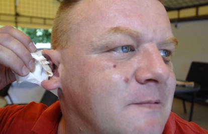 Policajac Tyson: 'Odgrizao mi je komad uha u tučnjavi'