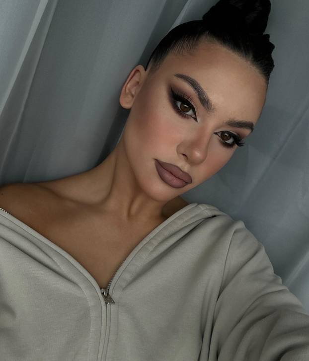 FOTO Putinova ljubimica imala je velike planove. Morala je na operaciju i tu joj je počeo pakao