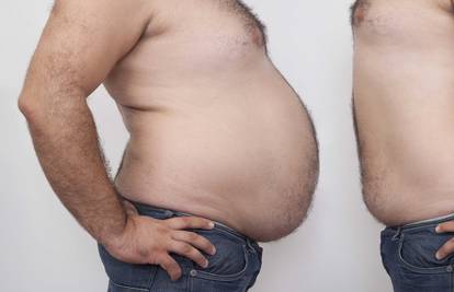 Izgubio više od 100 kg i tvrdi: Dijetama nećete ništa postići