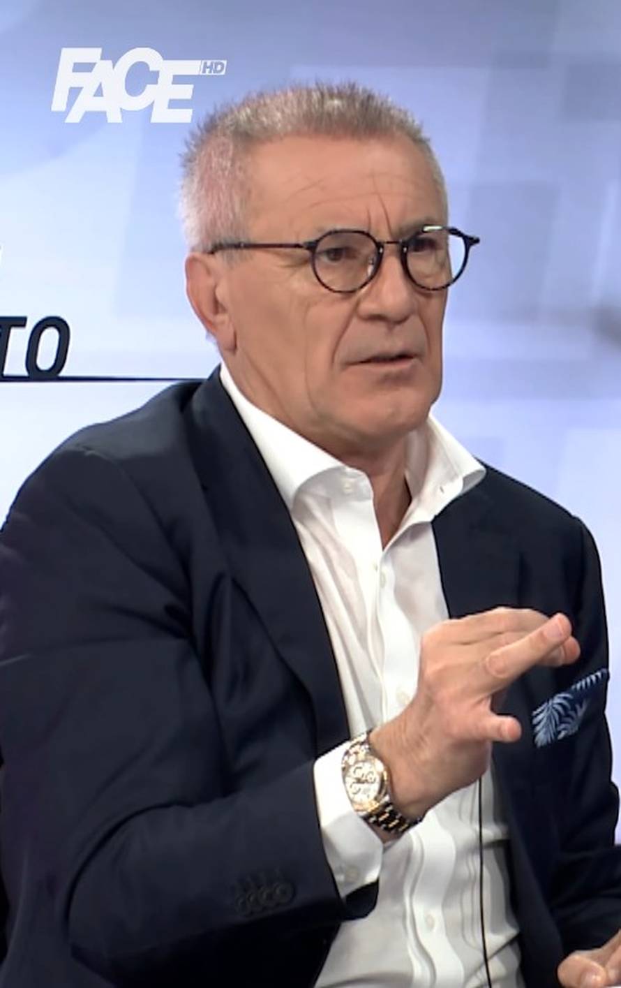 'Zdravko ježić': 'Bio na bolnoj transplantaciji kose i još se nije primilo na svim dijelovima'