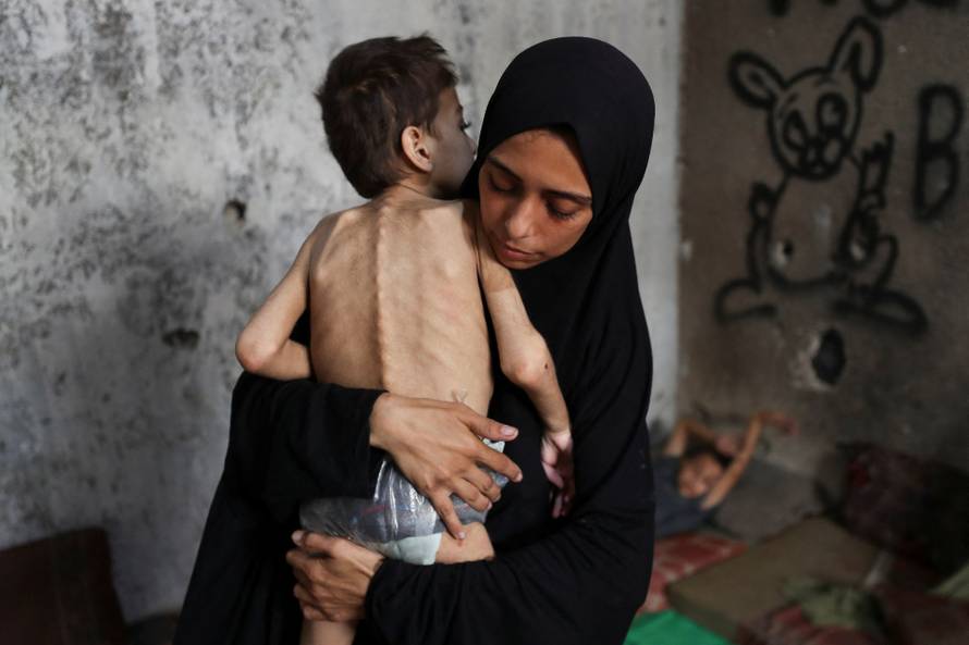 Displaced Palestinian mother Samah Matar holds her malnourished son Youssef, in Gaza City