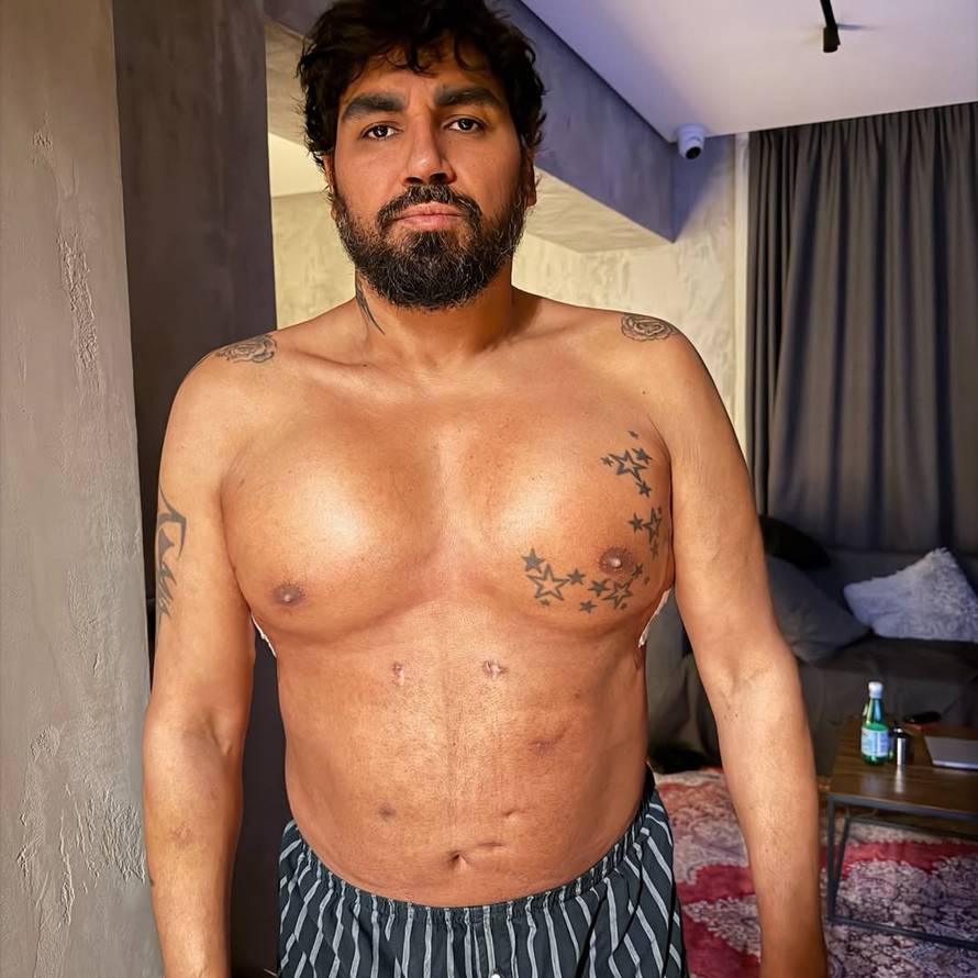 Azis pokazao natečena prsa nakon ugradnje silikona: Prije 3 godine snimio je duet sa Sevom