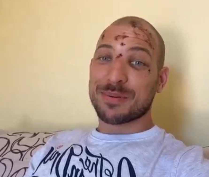 'Savršeni' Mijo šivao glavu: Više nikad neću ovako skočiti u more, dobio sam tri šava...