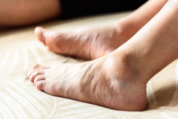 10 znakova da unosite previše proteina - i 10 da ih vašem tijelu kronično nedostaje