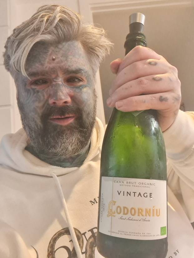 FOTO Više mu ne stane nijedna tetovaža! Uklonio je i bradavice. Evo kako je prije izgledao: Wow