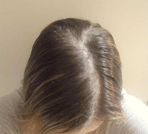 6 dana od pranja kose