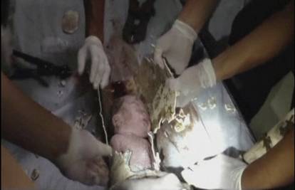 Čudom preživjela: Iz odvodne cijevi izvukli tek rođenu bebu