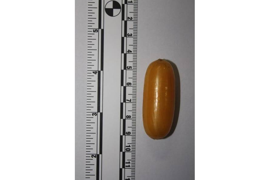 Ekskluzivne fotografije: Ovo je Brazilka koja je progutala kilu koke, doveli je u Veliku Goricu