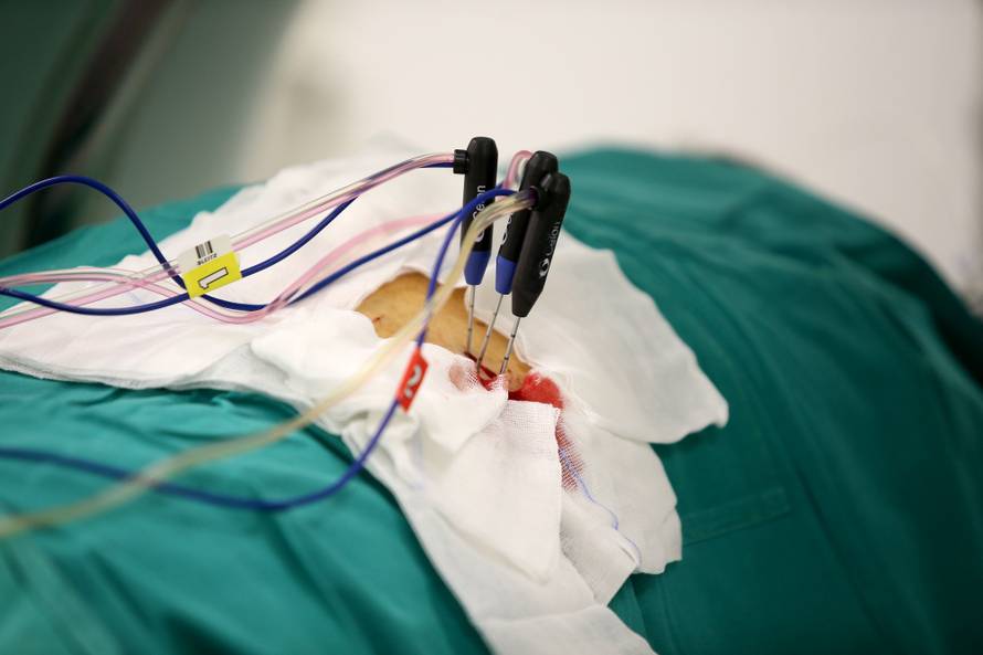 Tumor su mu spržili strujom: 'Sada mogu postati svećenik!'