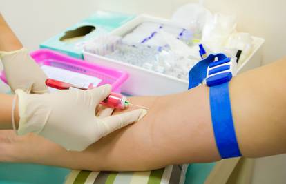 Krvne pretrage: Otkrijte kako protumačiti uobičajene nalaze 