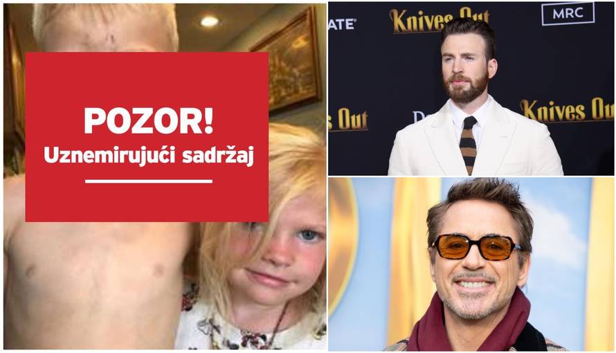 Dječak je spasio sestru od psa, superjunaci ga hvale: Ti si heroj