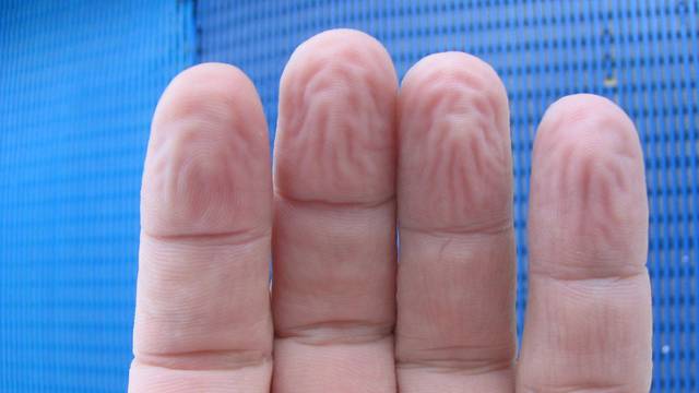 Saznali smo zašto nam se prsti smežuraju kada su dugo u vodi
