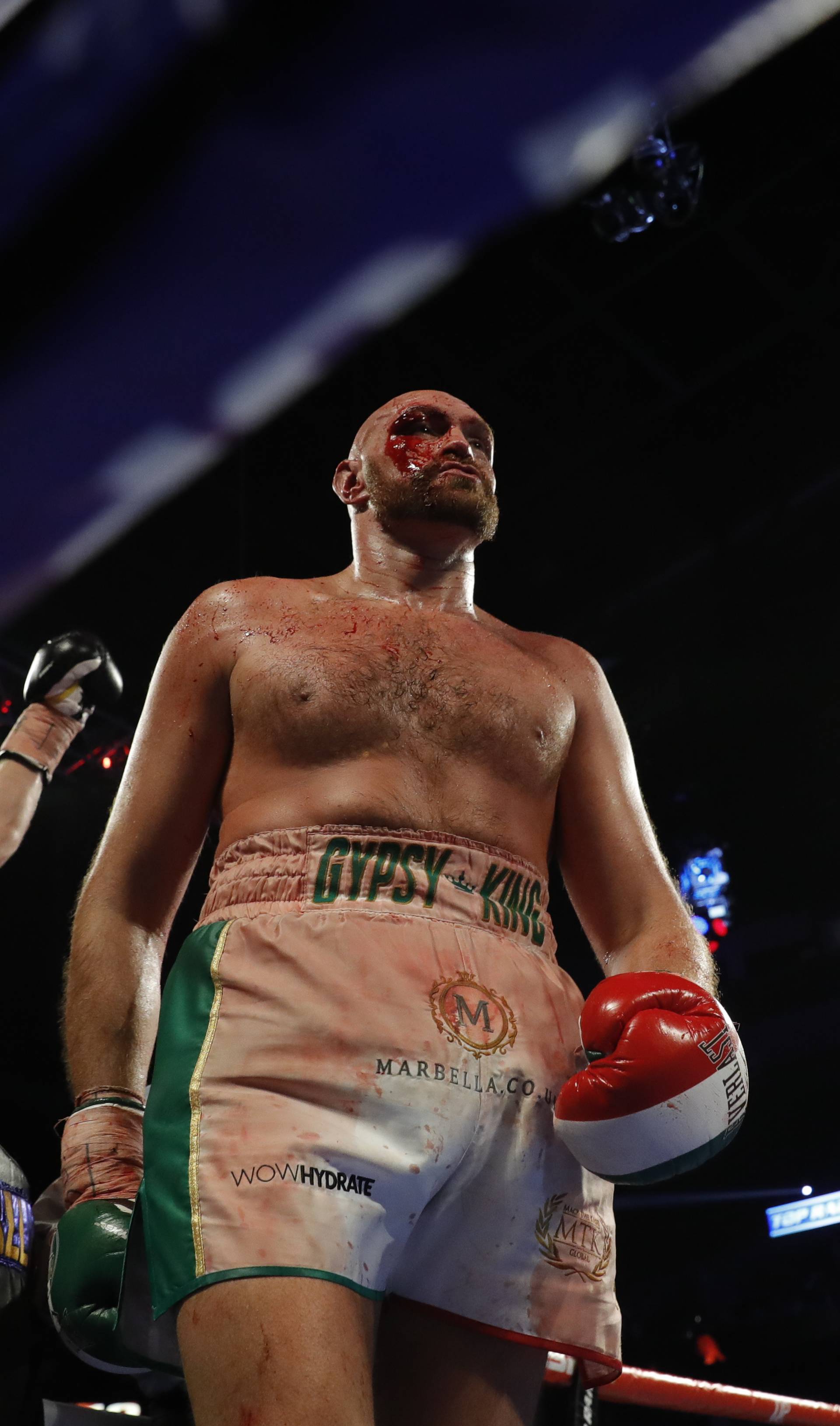 Tyson Fury v Otto Wallin