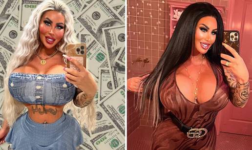 FOTO Berlinska Barbie uzela lovu bake, ulupala 36.000  € u operacije: 'Ja sam umjetnost'