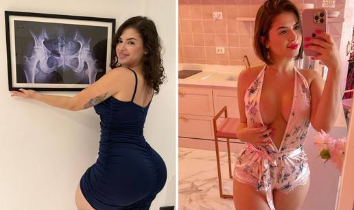 FOTO Brazilka na zid postavila rendgenski snimak vlastite stra&zcaron;njice: 'Da, prirodna je...'