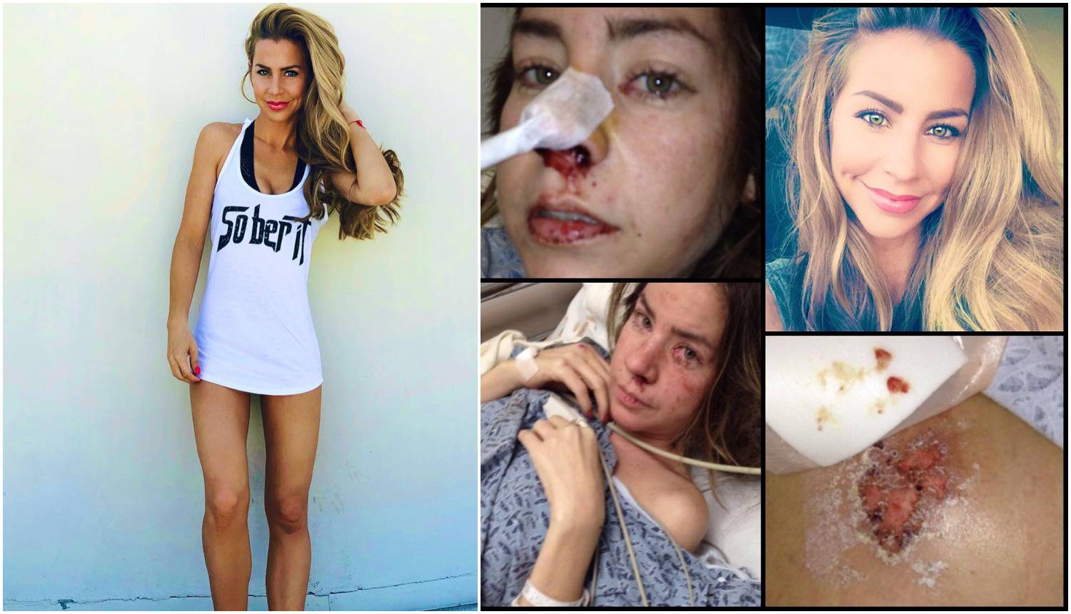 Playboy zečica: Pila sam votku 24 sata dnevno i povraćala krv