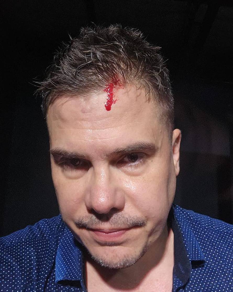 Luka Vidović opet u 'sukobu' sa staklom: Fata je Fata, al dvaput je dvaput. Pobijedilo me opet...