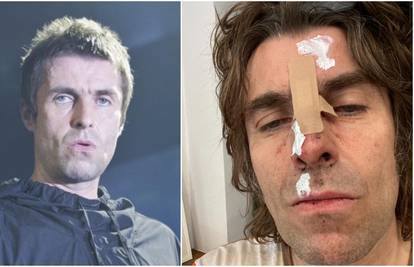 Liam Gallagher u masnicama nakon pada iz helikoptera: 'Sad imam fotku za cover albuma'