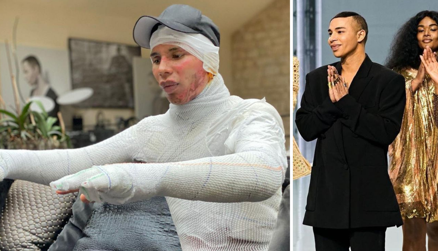 Dizajner godinu dana skrivao tešku nesreću: 'Bilo me je sram'