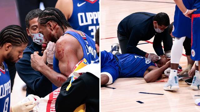 Užas u NBA-u: Zubac gledao u šoku krvavog Kawhija na podu
