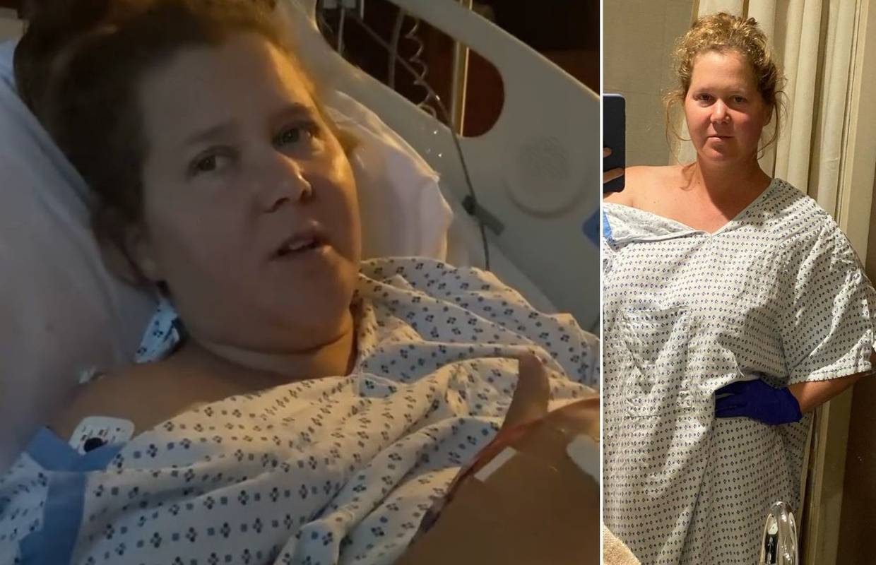 Glumica Amy Schumer: 'Morala sam izvaditi maternicu i slijepo crijevo zbog endomtrioze'