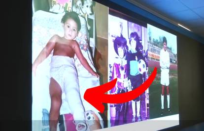 Novi trener Rijeke iznenadio je fotkom iz djetinjstva: 'Rekli su mi da ću šepati do kraja života'