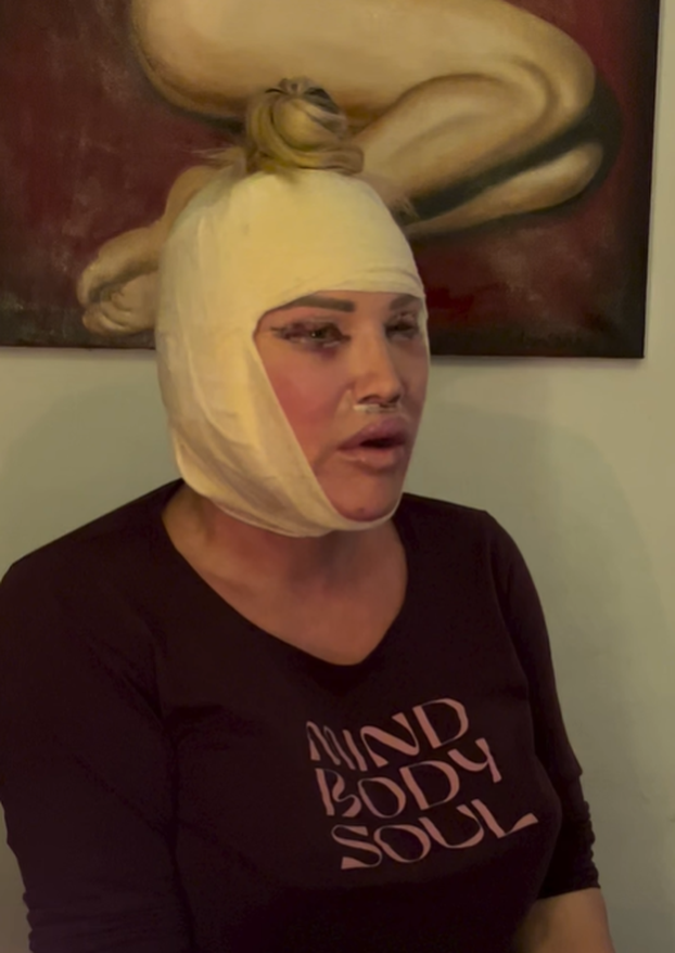 FOTO Prva je u Hrvatskoj pričala o promjeni spola: Salome je išla na facelifting, evo kako izgleda