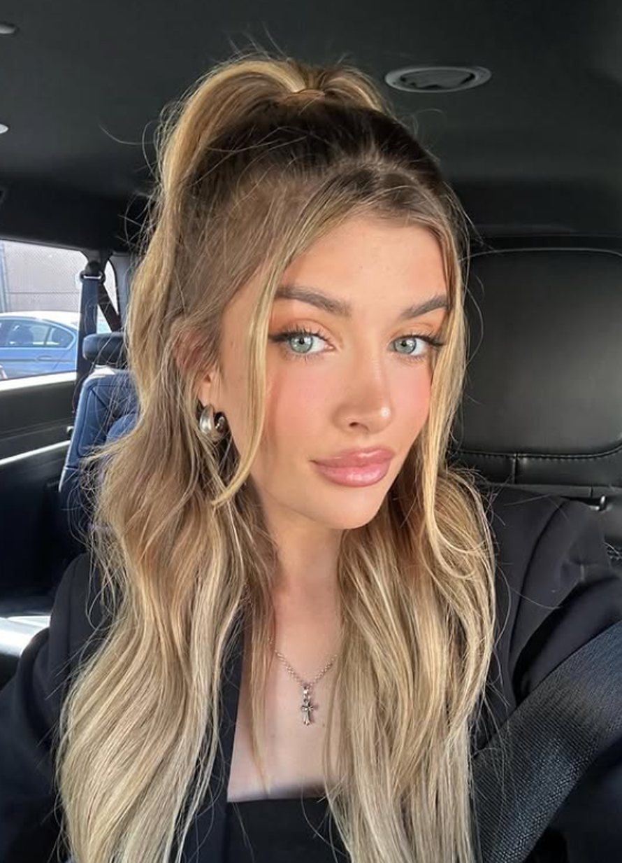 Kći Charlieja Sheena otkrila na koje je estetske zahvate išla