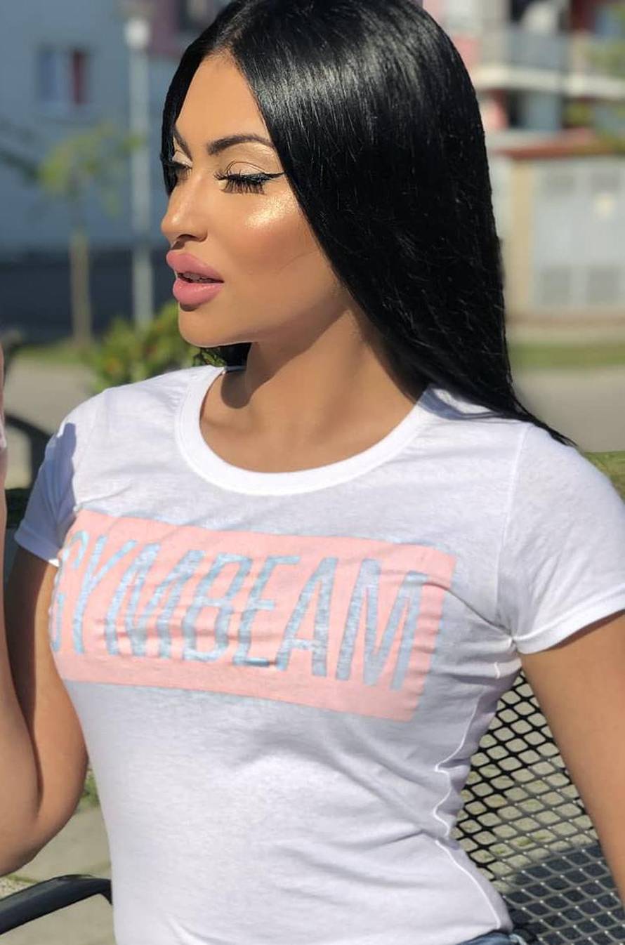 Hana Rodić priznala: U usne je ubrizgala dva mililitra filera...