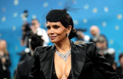 Što joj je to na preponi, prištić ili samo nezgodna sjena? Halle Berry otkrila sve na Met Gali