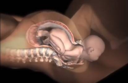 Nevjerojatno: Mala vagina, a velika beba - kako izađe van?