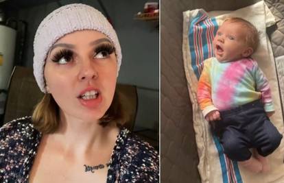 Nevjerojatna situacija: Oko joj 'iskočilo' iz glave dok je rađala!