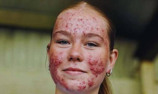 'Sretno, Skye!': Nogometna tinejdžerica postala je meta trolova, ali i simbol podrške