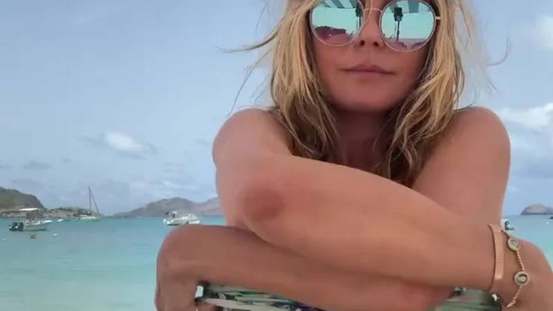 FOTO Heidi je sedmu godišnjicu braka proslavila u toplesu