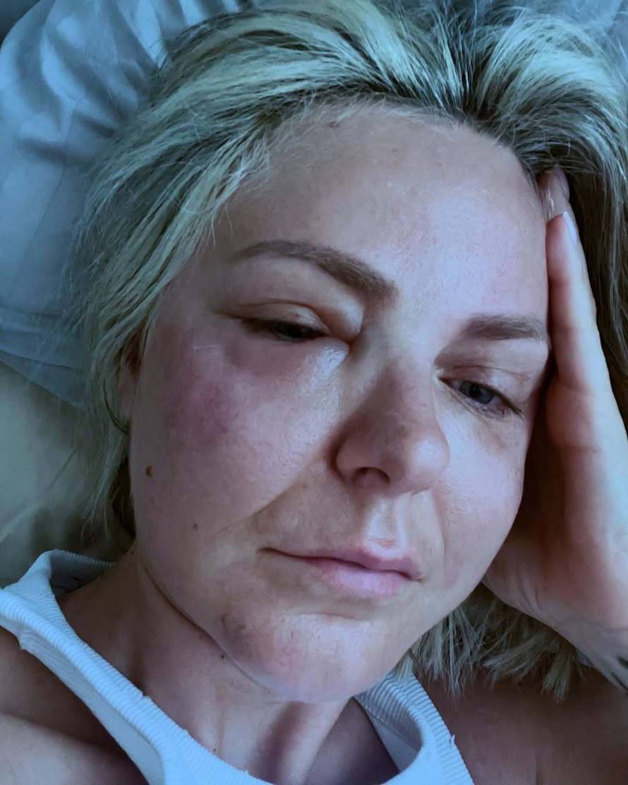 Stankica iz 'Savršenog': Traume od estetskih operacija su me potakle da učim za psihologa