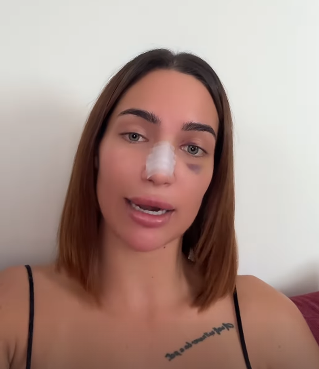 FOTO Sve za ljepotu! Naši slavni ne boje se ići 'pod nož': Sredili su grudi, usne, presađuju kosu