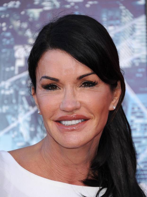 Poznata lica koja su se promijenila zbog velike koli?ine botoksa