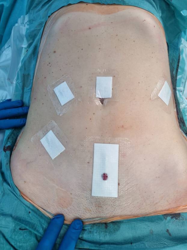 FOTO: KLINI&Ccaron;KA BOLNICA DUBRAVA