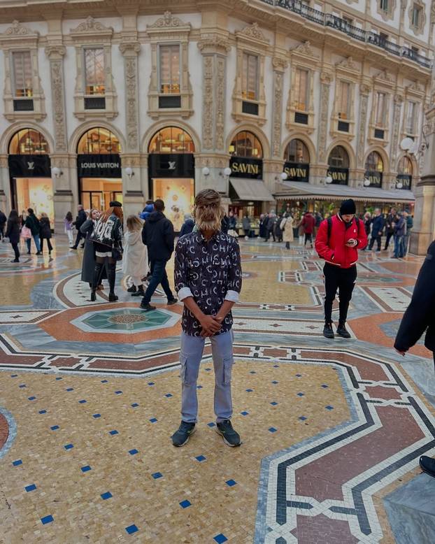 FOTO Ovaj mladić (18) pati od sindroma vukodlaka: U školi me sprdaju, ali volim svoje dlake...