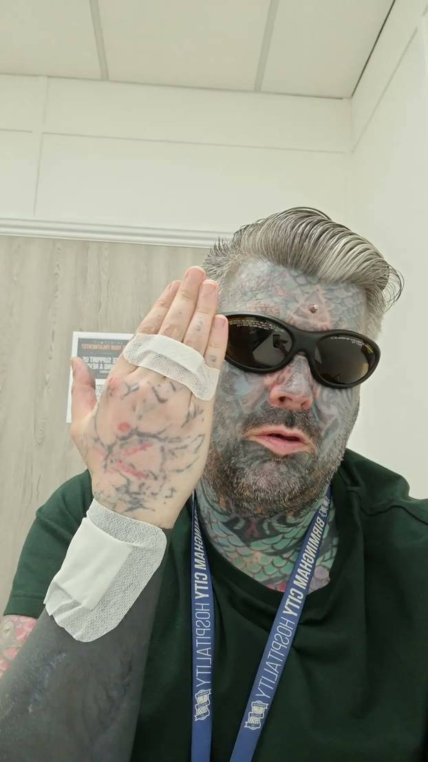 FOTO Više mu ne stane nijedna tetovaža! Uklonio je i bradavice. Evo kako je prije izgledao: Wow