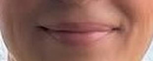 MEGAKVIZ Možete li prepoznati ove poznate samo po usnama i osmijehu? Tko će sve pogoditi?